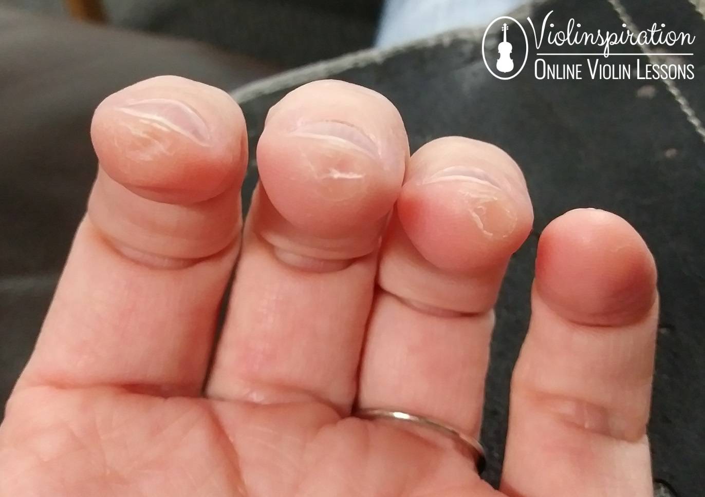 Differences Between a Violin and a Guitar - Calluses